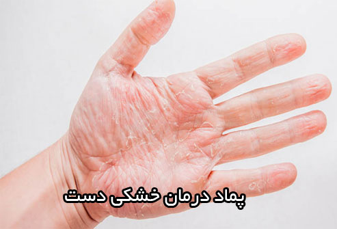 بهترین پماد برای خشکی پوست دست