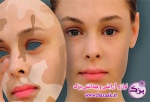 درمان لک سفید صورت
