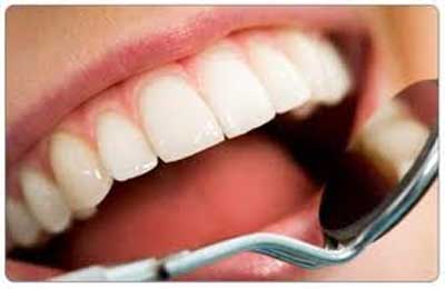روش هایی ساده برای سفید ماندن دندانها