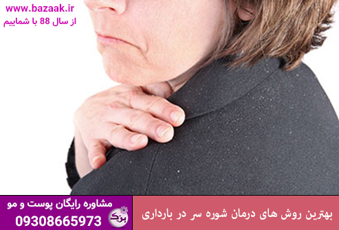 بهترین روش‌ های درمان شوره سر در بارداری