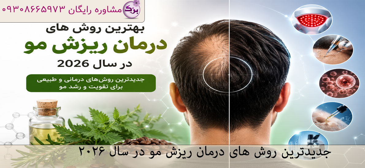 جدیدترین روش های درمان ریزش مو در سال 2026