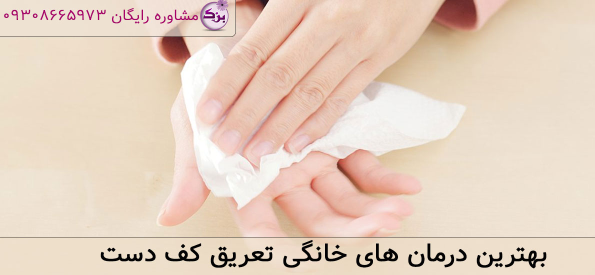 بهترین درمان‌ های خانگی تعریق کف دست (هایپرهیدروزیس)