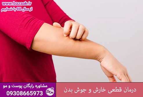 درمان قطعی خارش و جوش بدن
