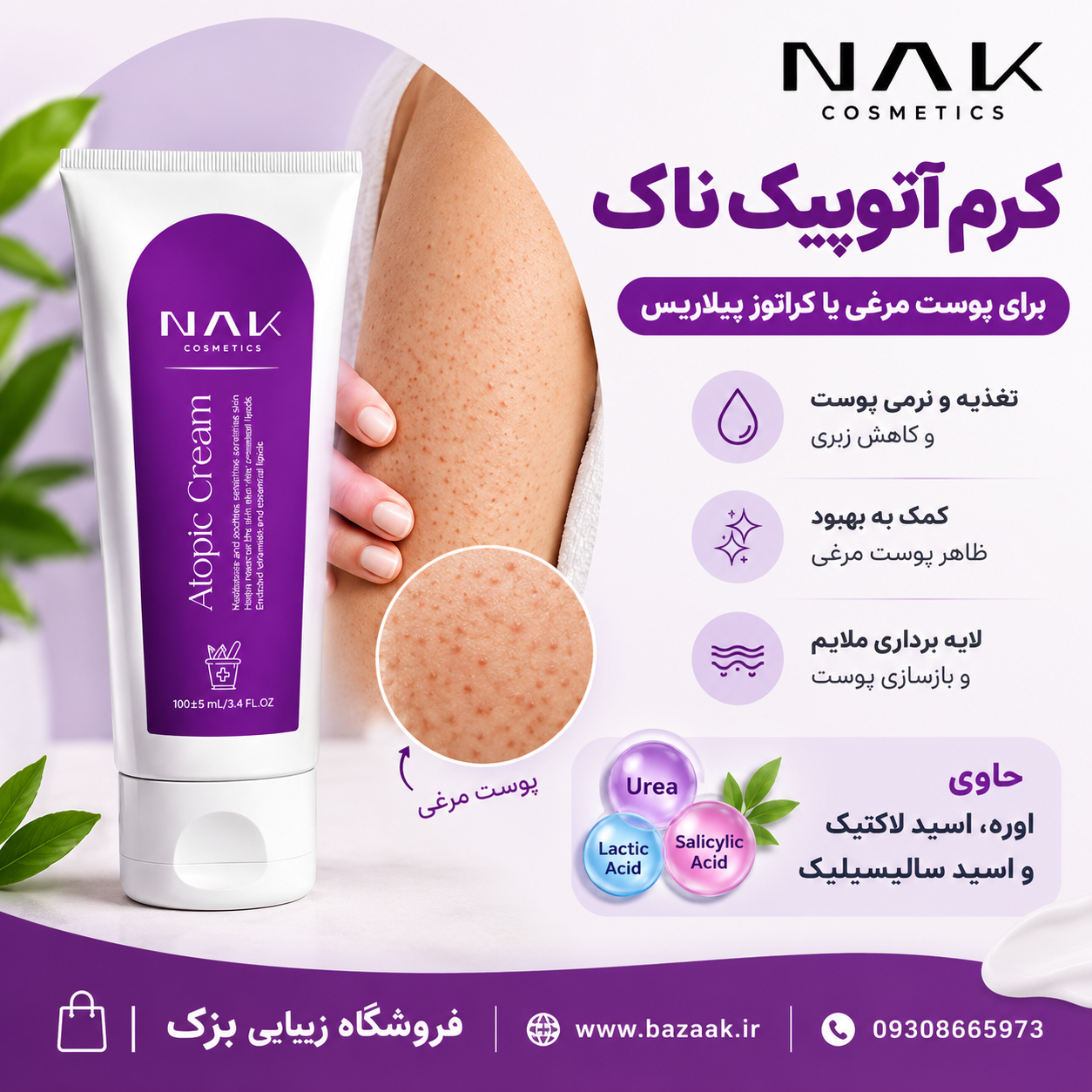 کرم آتوپیک ناک برای پوست مرغی 