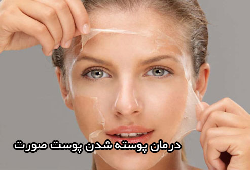درمان قرمزی و پوسته پوسته شدن پوست صورت