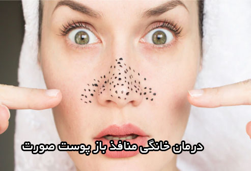 درمان خانگی منافذ باز پوست صورت