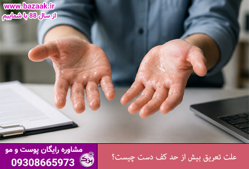 علت تعریق بیش از حد کف دست چیست؟