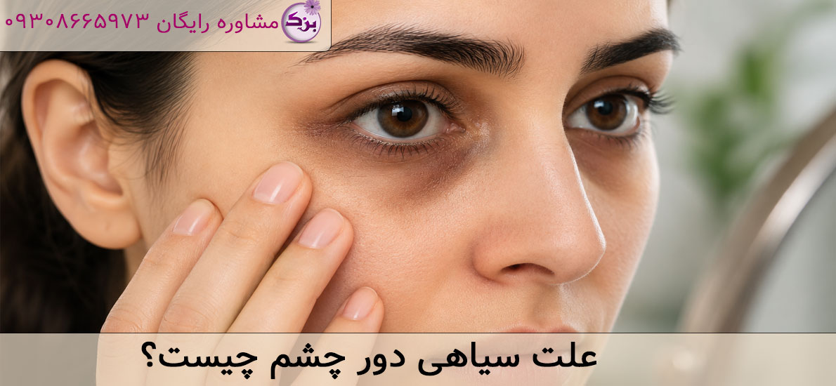 علت سیاهی دور چشم چیست؟ راهنمای کامل علت ها، درمان و پیشگیری