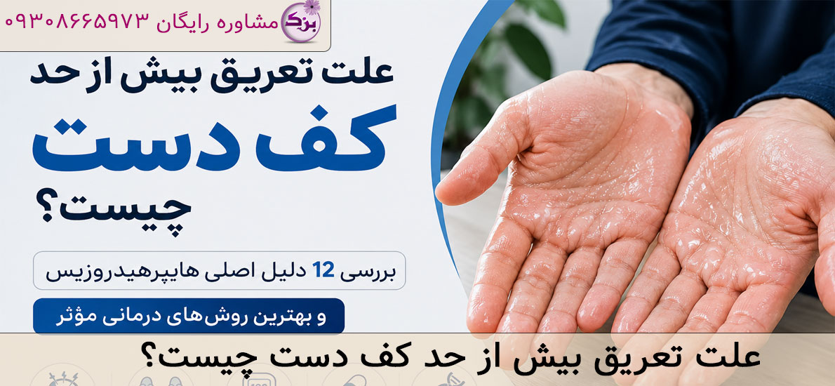 علت تعریق بیش از حد کف دست چیست؟ 12 دلیل اصلی هایپرهیدروزیس و روش‌ های درمان