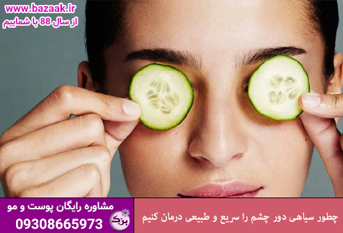 چطور سیاهی دور چشم را سریع و طبیعی درمان کنیم