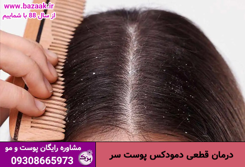 درمان قطعی دمودکس پوست سر