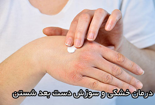 درمان خشکی و سوزش دست بعد از شستن