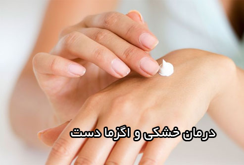 درمان خشکی و اگزما دست