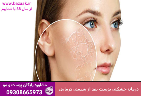 درمان خشکی پوست بعد از شیمی درمانی