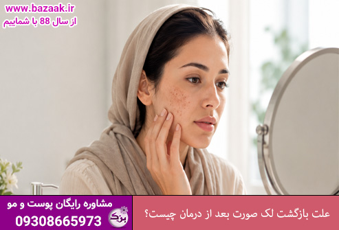 علت بازگشت لک صورت بعد از درمان چیست؟ راه‌های جلوگیری از عود لک