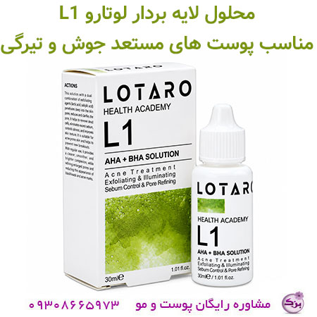 محلول لایه بردار لوتارو