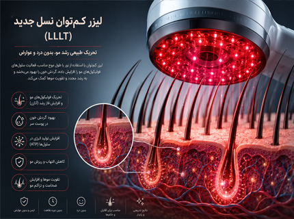 لیزر کمتوان LLLT برای تحریک فولیکولهای مو و افزایش رشد مو
