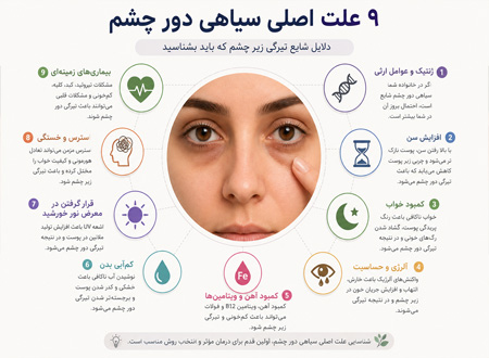 علت سیاهی دورچشم