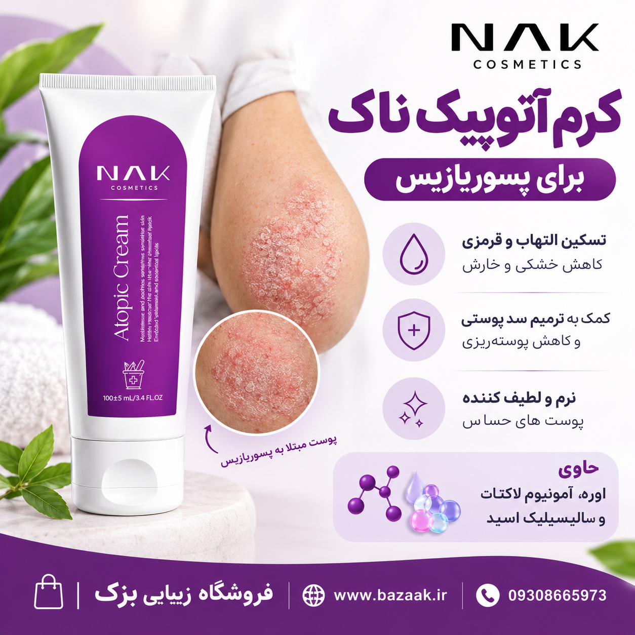 کرم آتوپیک ناک برای پسوریازیس