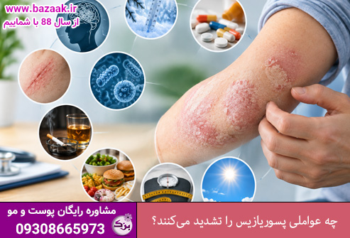 چه عواملی پسوریازیس را تشدید می‌کنند؟