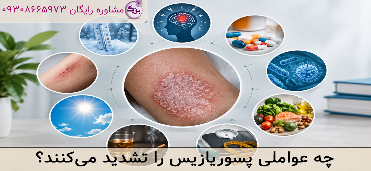 چه عواملی پسوریازیس را تشدید می‌کنند؟