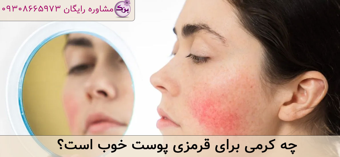 چه کرمی برای قرمزی پوست خوب است؟