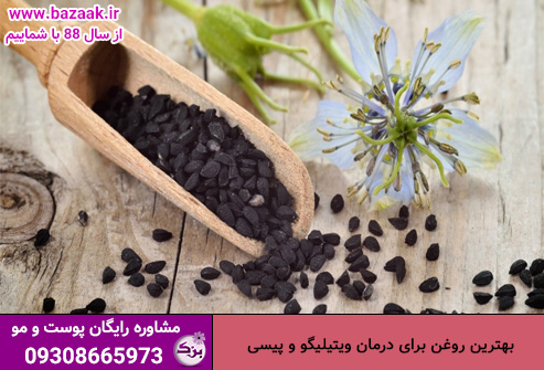 بهترین روغن برای درمان ویتیلیگو و پیسی