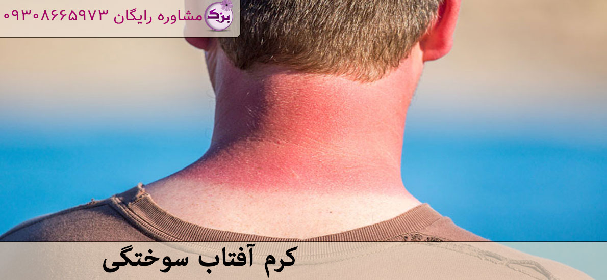 کرم آفتاب سوختگی