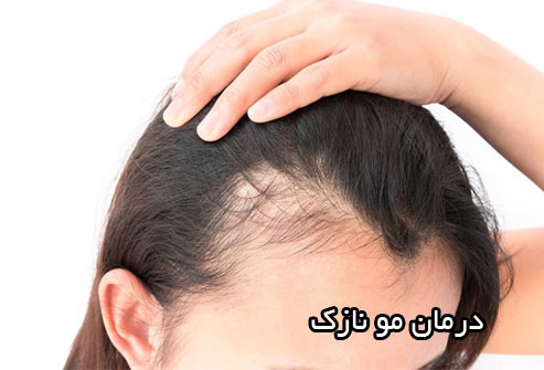 علت و درمان نازکی مو
